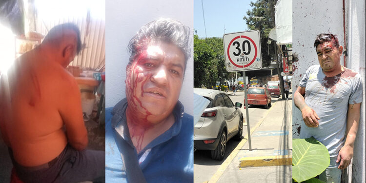 Golpean brutalmente a comerciantes antorchistas frente al Hospital de Ortopedia de Puebla