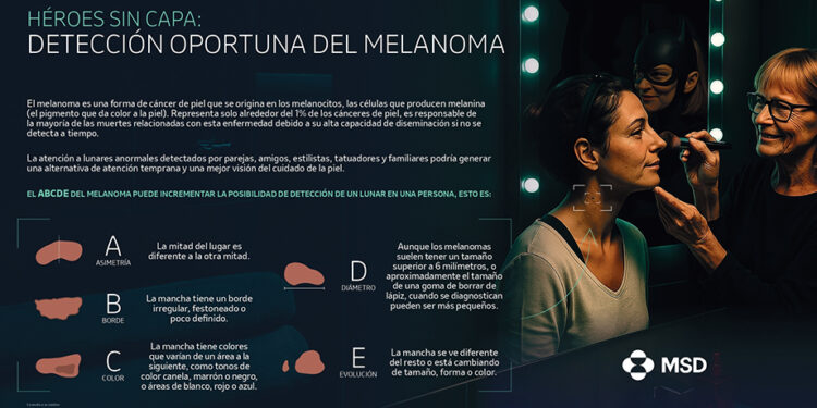 Melanoma: La observación de lunares y manchas podría marcar la diferencia