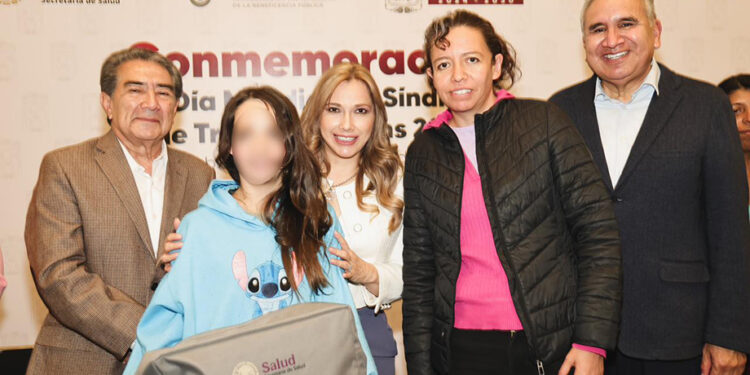 SEDIF y Beneficencia Pública Nacional transforman vidas de niñas y niños con Síndrome de Treacher Collins